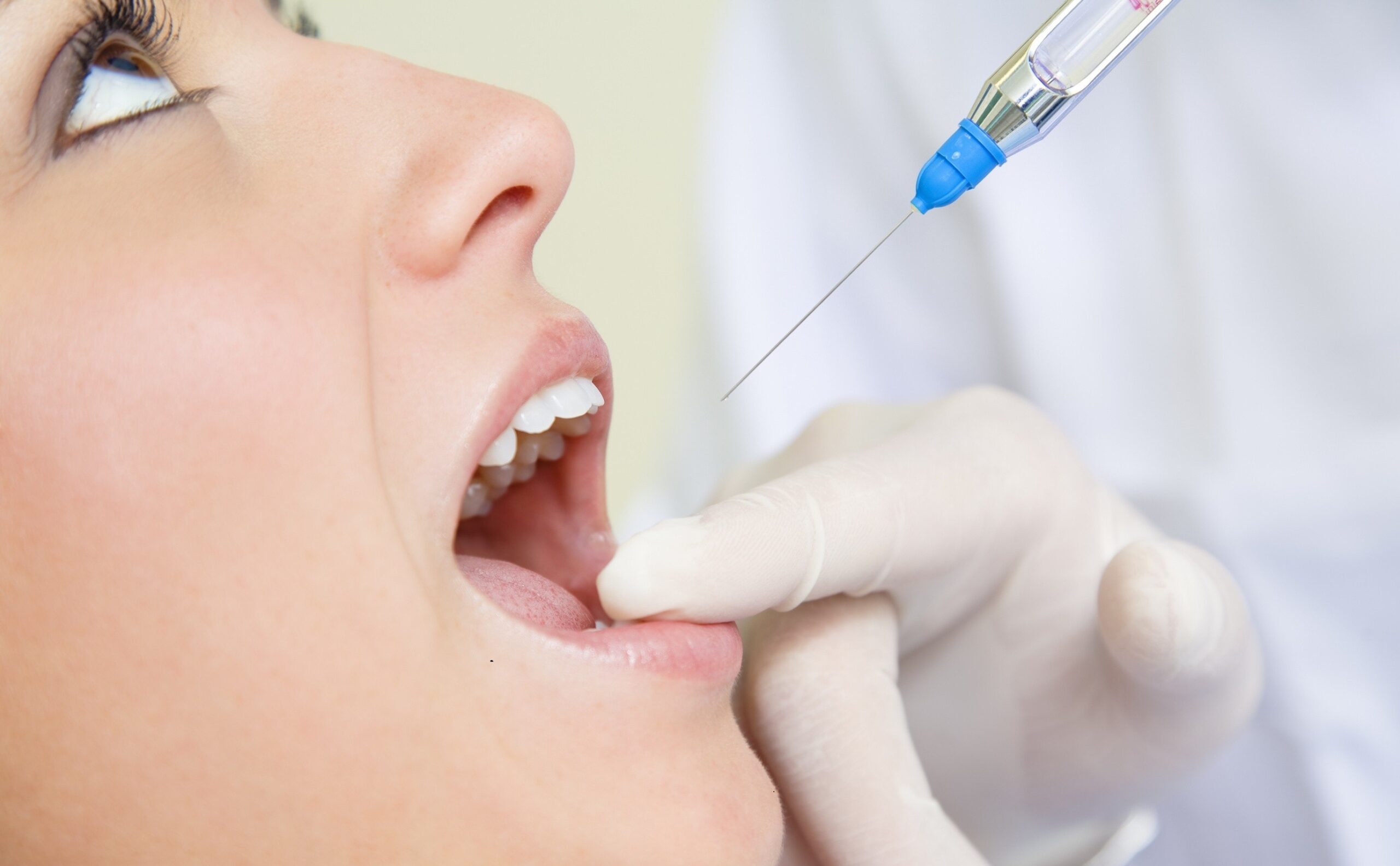 What Local Anesthesia Do Dentists Use?