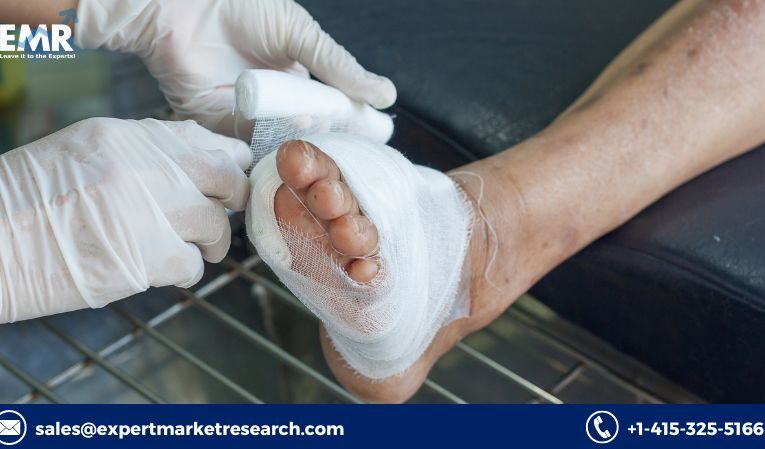 Global Diabetic Ulcer Treatment Market Growth, Analysis, Key Players, Outlook, Report, Forecast 2023-2028